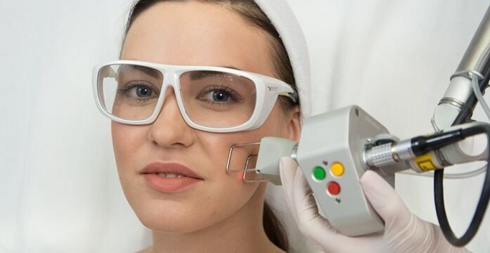 laser facial skin rejuvenation procedure