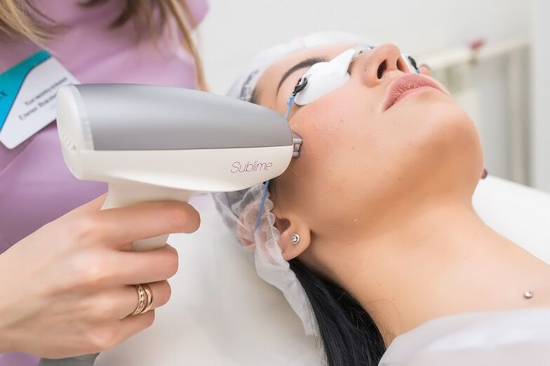 carrying out a procedure for laser skin rejuvenation